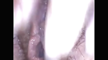 Esplorazione di una bellissima figa pelosa con endoscopio medicale buon divertimento