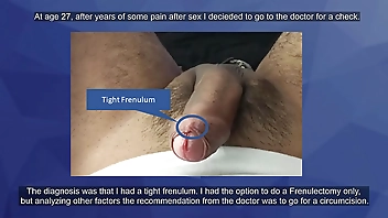 Circumcision?? Check this out.